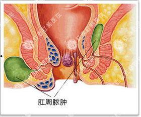 肛门试体温视频,操作步骤与注意事项